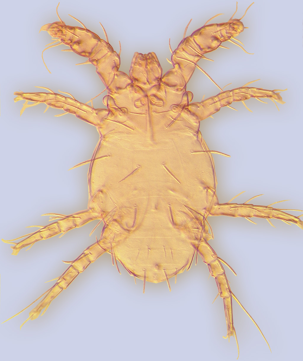 Trochometridium tribulatum, phoretic female, ex Melissodes sp., USA: Arizona, BMOC 03-0821-006