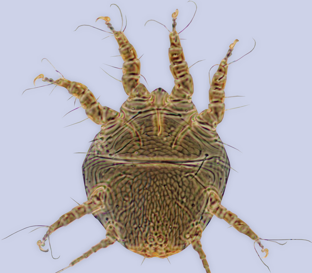 Chaetodactylus dementjevi, phoretic deutonymph, ex Chalicodoma bombycina, Russia: Leningradskaya Oblast
