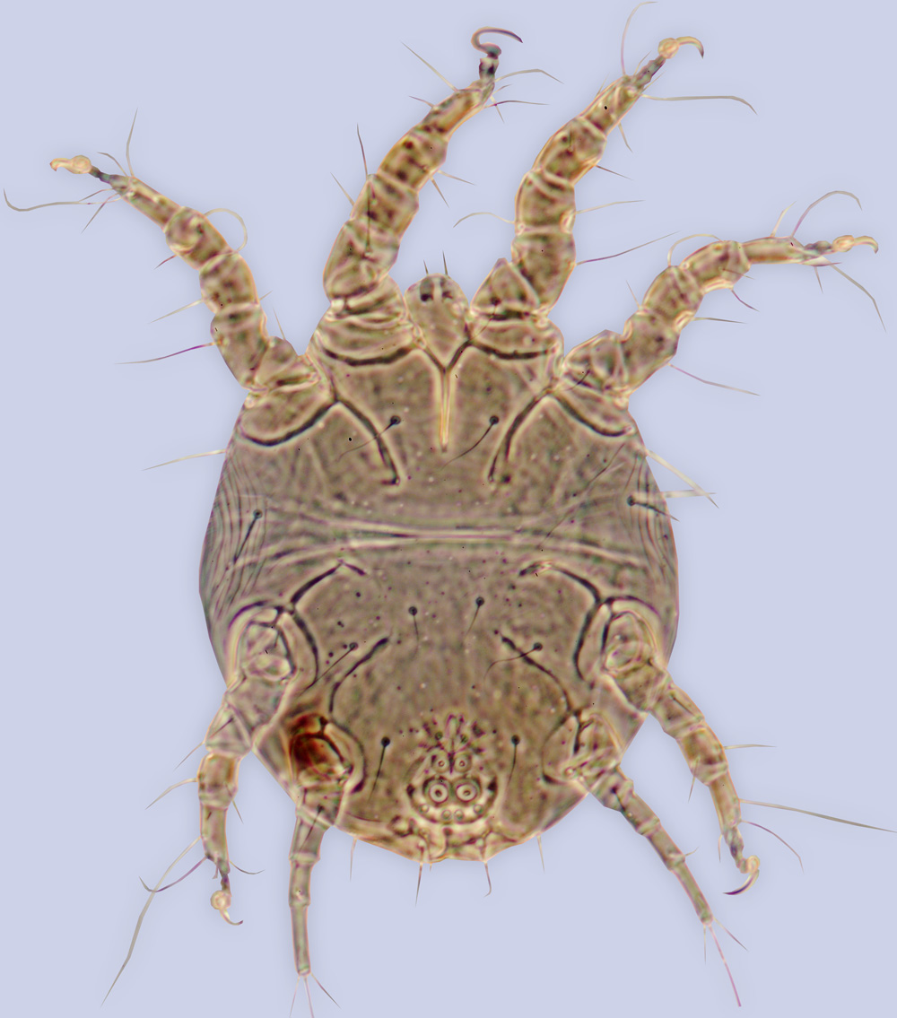 Chaetodactylus furunculus, phoretic deutonymph, ex Lithurgus listrotus, California, BMOC 04-1122-002