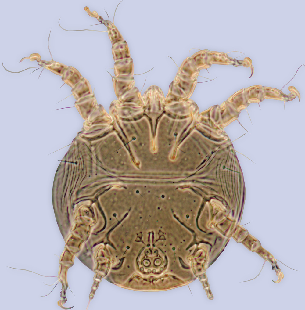 Chaetodactylus kouboy, phoretic deutonymph, holotype, ex Lithurgus apicalis, New Mexico, BMOC 95-0323-020