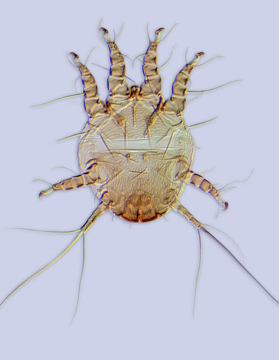 Mite Chaetodactylus krombeini. (Chaetodactylidae)