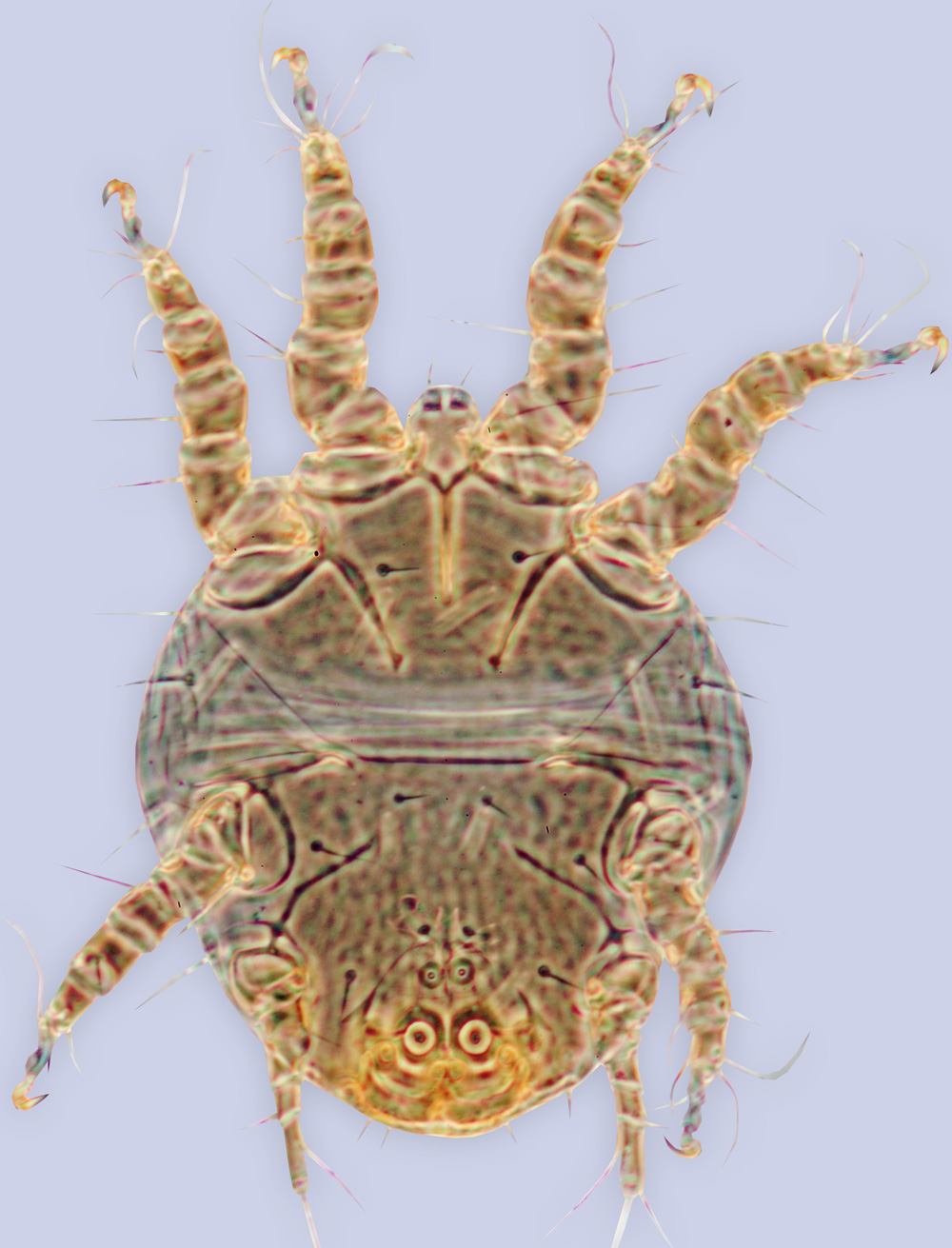 Chaetodactylus ludwigi, phoretic deutonymph, ex Lithurgus scabrosus, New Caledonia, BMOC 91-1015-010