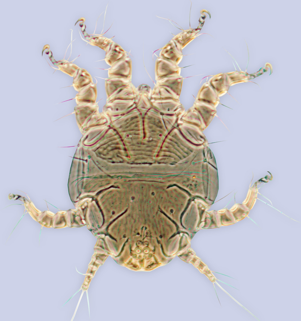 Chaetodactylus dementjevi, phoretic deutonymph, ex Chalicodoma bombycina, Finland, BMOC 96-0510-196