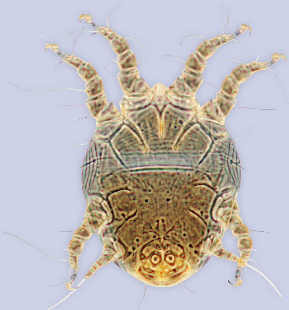 Chaetodactylus rozeni, phoretic deutonymph, ex Osmia georgica, North Carolina, BMOC 04-0508-007